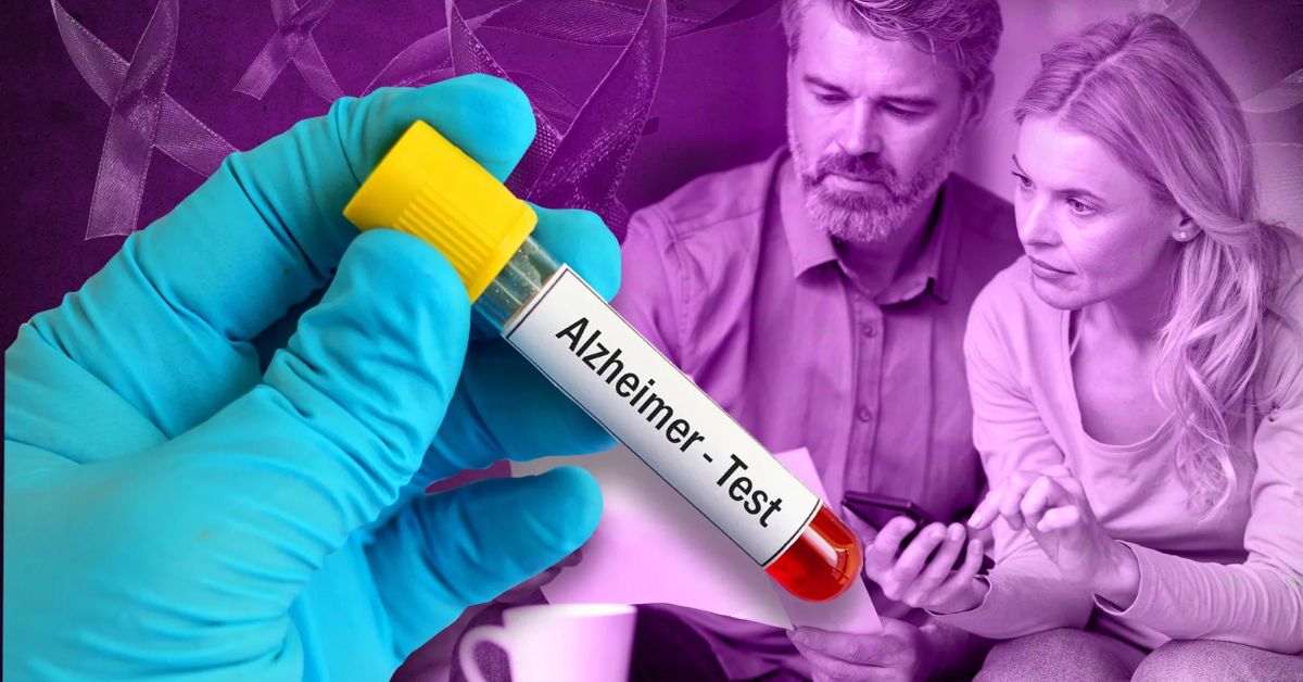 Blood Test for Dementia or Alzheimer