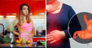 Best natural remedies for bloating and gas
