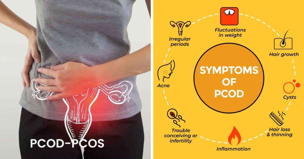 PCOD Symptoms